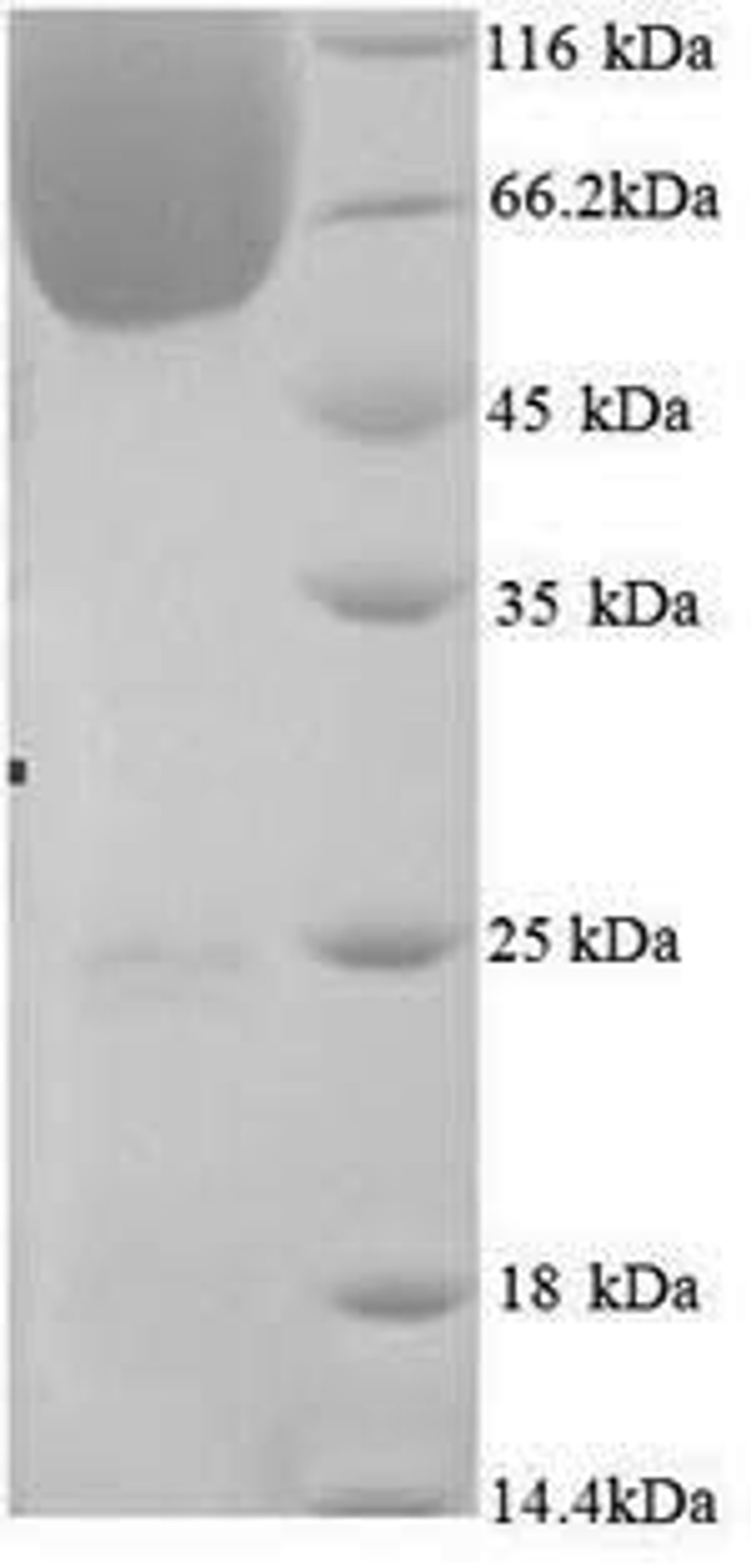 (Tris-Glycine gel) Discontinuous SDS-PAGE (reduced) with 5% enrichment gel and 15% separation gel.