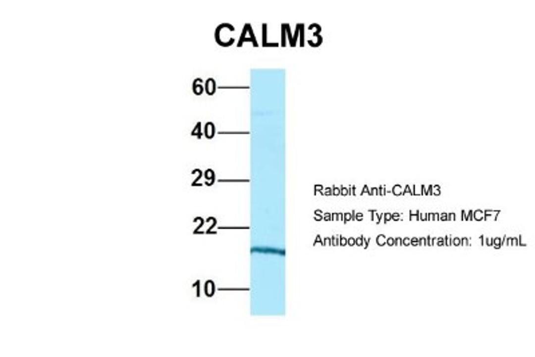 Western Blot: Calmodulin 3 Antibody [NBP1-98474] - Human MCF7, Antibody Dilution: 1.0 ug/ml CALM3 is strongly supported by BioGPS gene expression data to be expressed in MCF7.