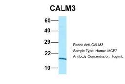 Western Blot: Calmodulin 3 Antibody [NBP1-98474] - Human MCF7, Antibody Dilution: 1.0 ug/ml CALM3 is strongly supported by BioGPS gene expression data to be expressed in MCF7.