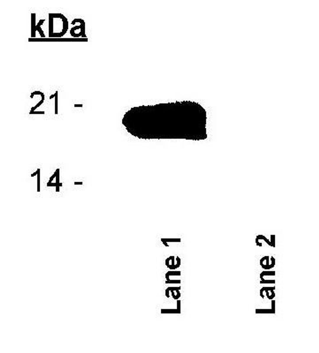 Western Blot: Survivin [p Thr34] Antibody [NB500-236] - Lane 1: Phosphorylated Survivin protein and Lane 2: Non-phosphorylated Survivin protein.