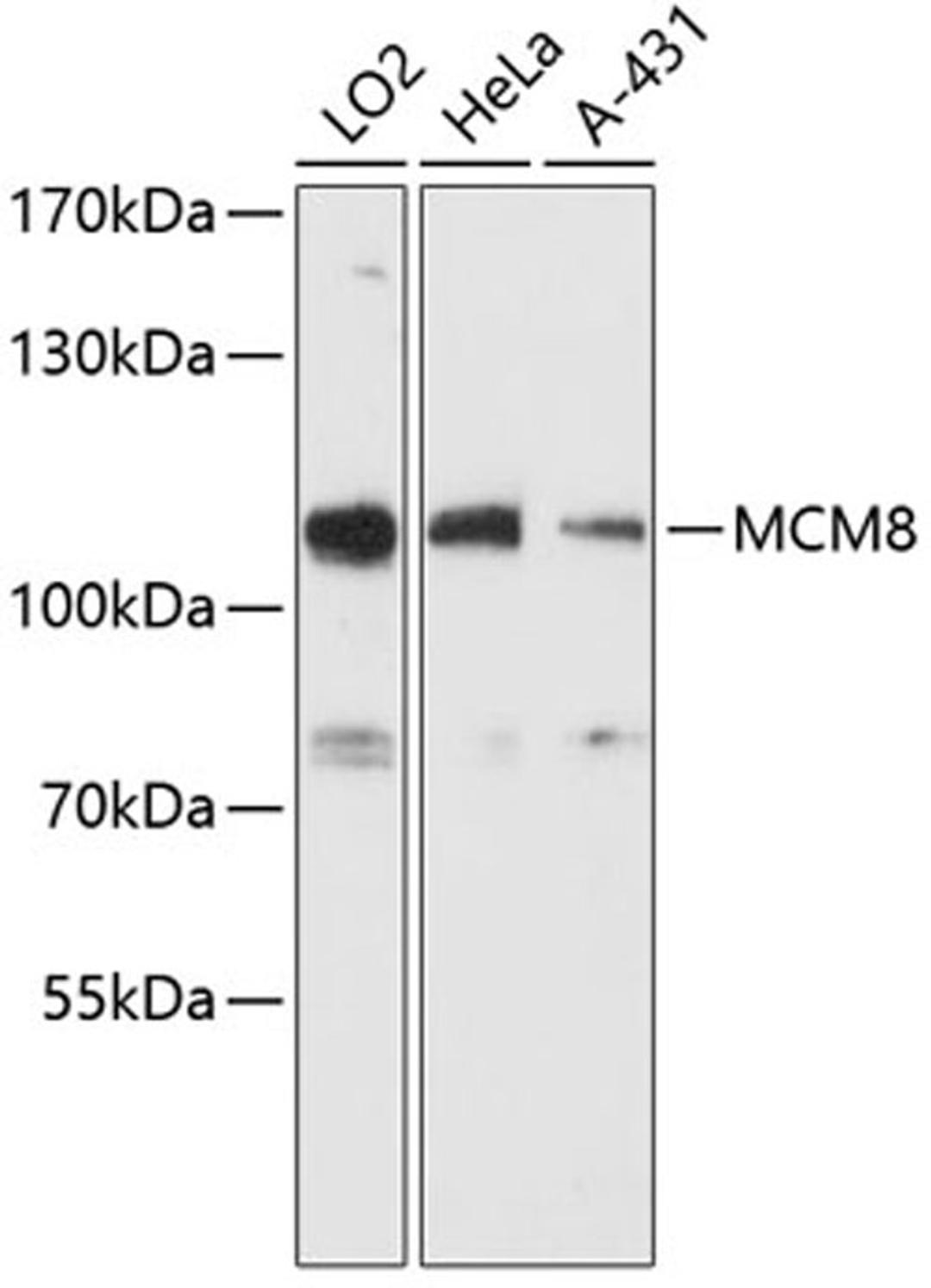 Western blot - MCM8 antibody (A12922)