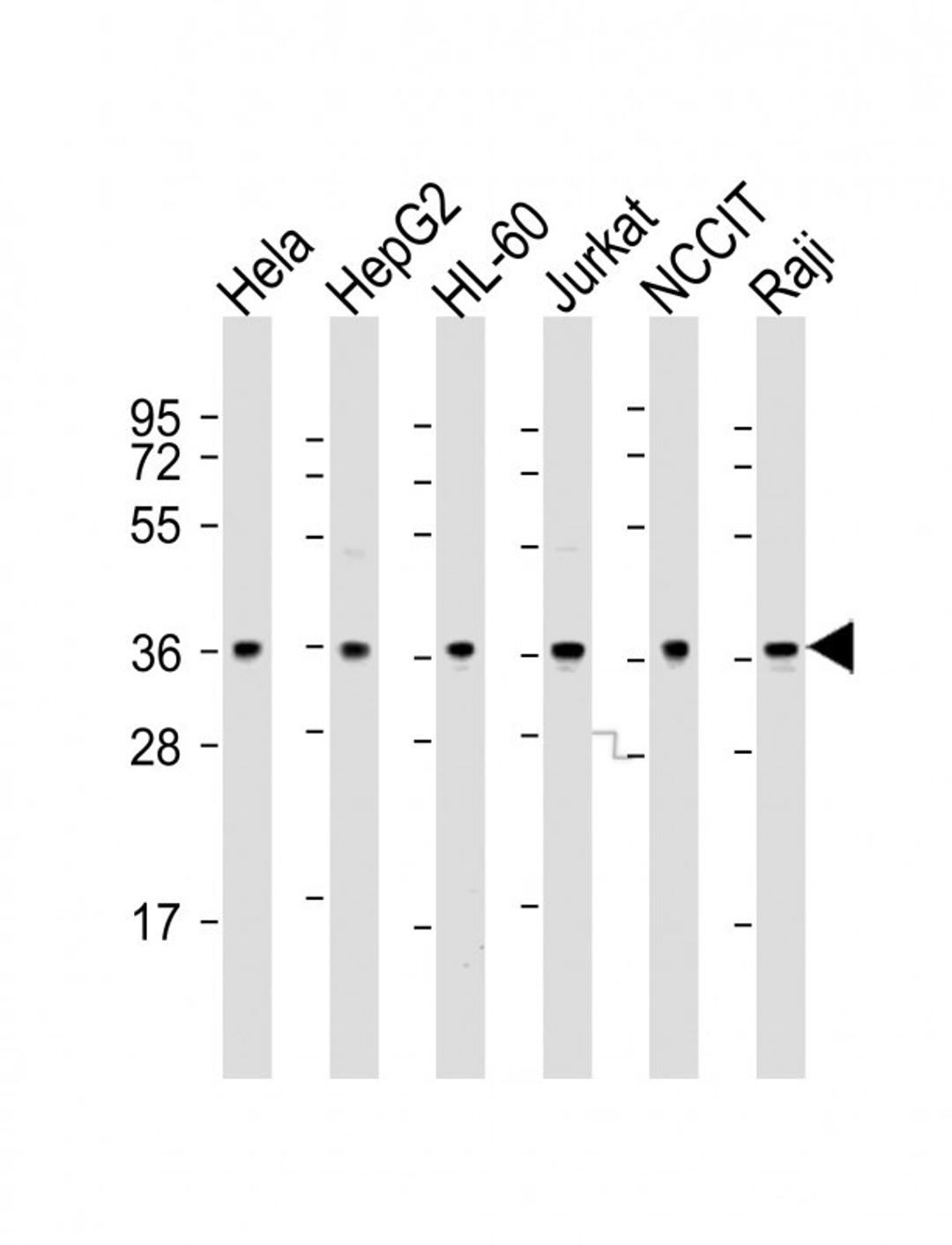 Western Blot at 1:2000 dilution Lane 1: Hela whole cell lysate Lane 2: HepG2 whole cell lysate Lane 3: HL-60 whole cell lysate Lane 4: Jurkat whole cell lysate Lane 5: NCCIT whole cell lysate Lane 6: Raji whole cell lysate Lysates/proteins at 20 ug per la