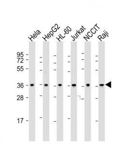 Western Blot at 1:2000 dilution Lane 1: Hela whole cell lysate Lane 2: HepG2 whole cell lysate Lane 3: HL-60 whole cell lysate Lane 4: Jurkat whole cell lysate Lane 5: NCCIT whole cell lysate Lane 6: Raji whole cell lysate Lysates/proteins at 20 ug per la