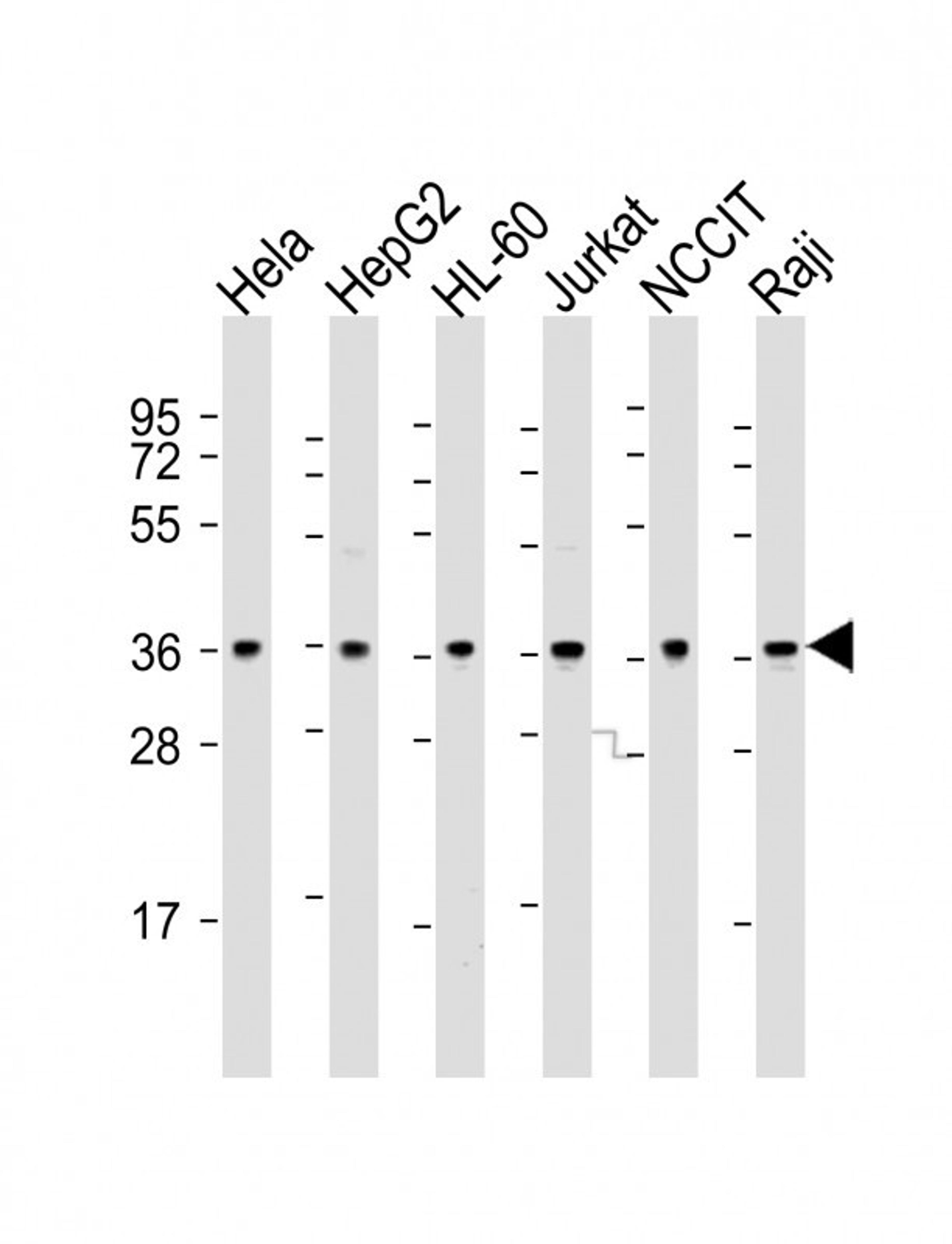 Western Blot at 1:2000 dilution Lane 1: Hela whole cell lysate Lane 2: HepG2 whole cell lysate Lane 3: HL-60 whole cell lysate Lane 4: Jurkat whole cell lysate Lane 5: NCCIT whole cell lysate Lane 6: Raji whole cell lysate Lysates/proteins at 20 ug per la