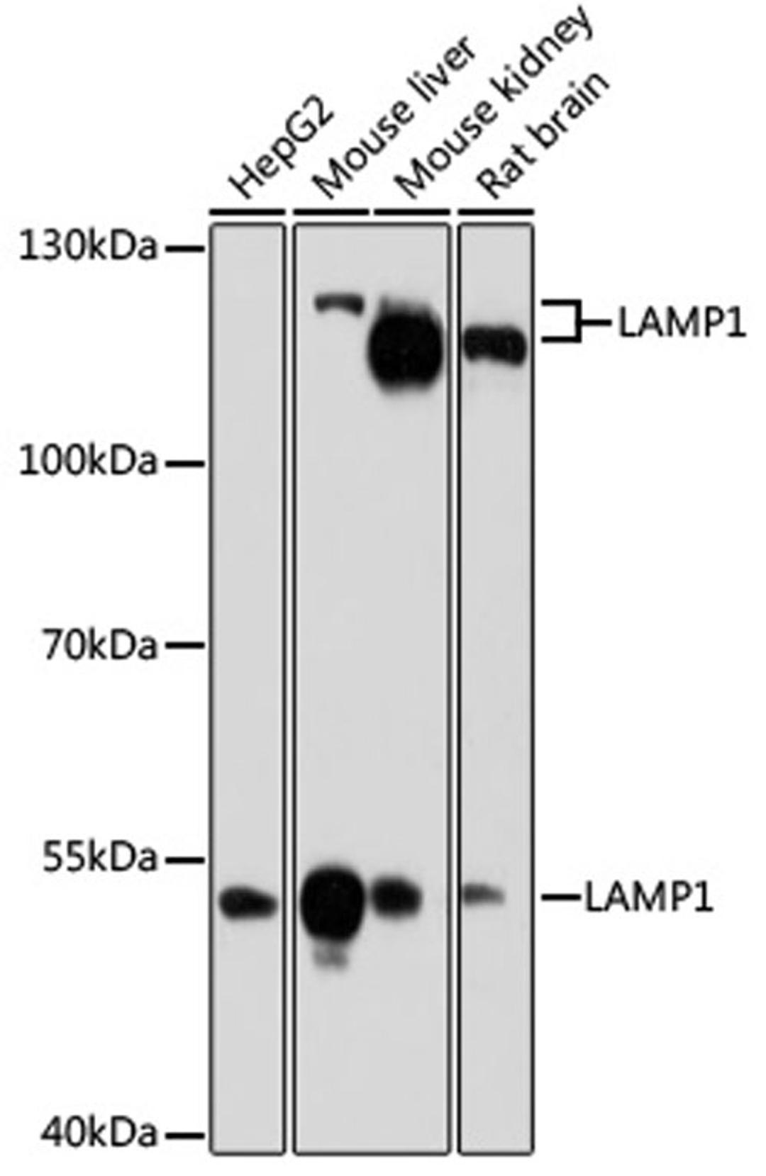 Western blot - LAMP1 antibody (A16894)