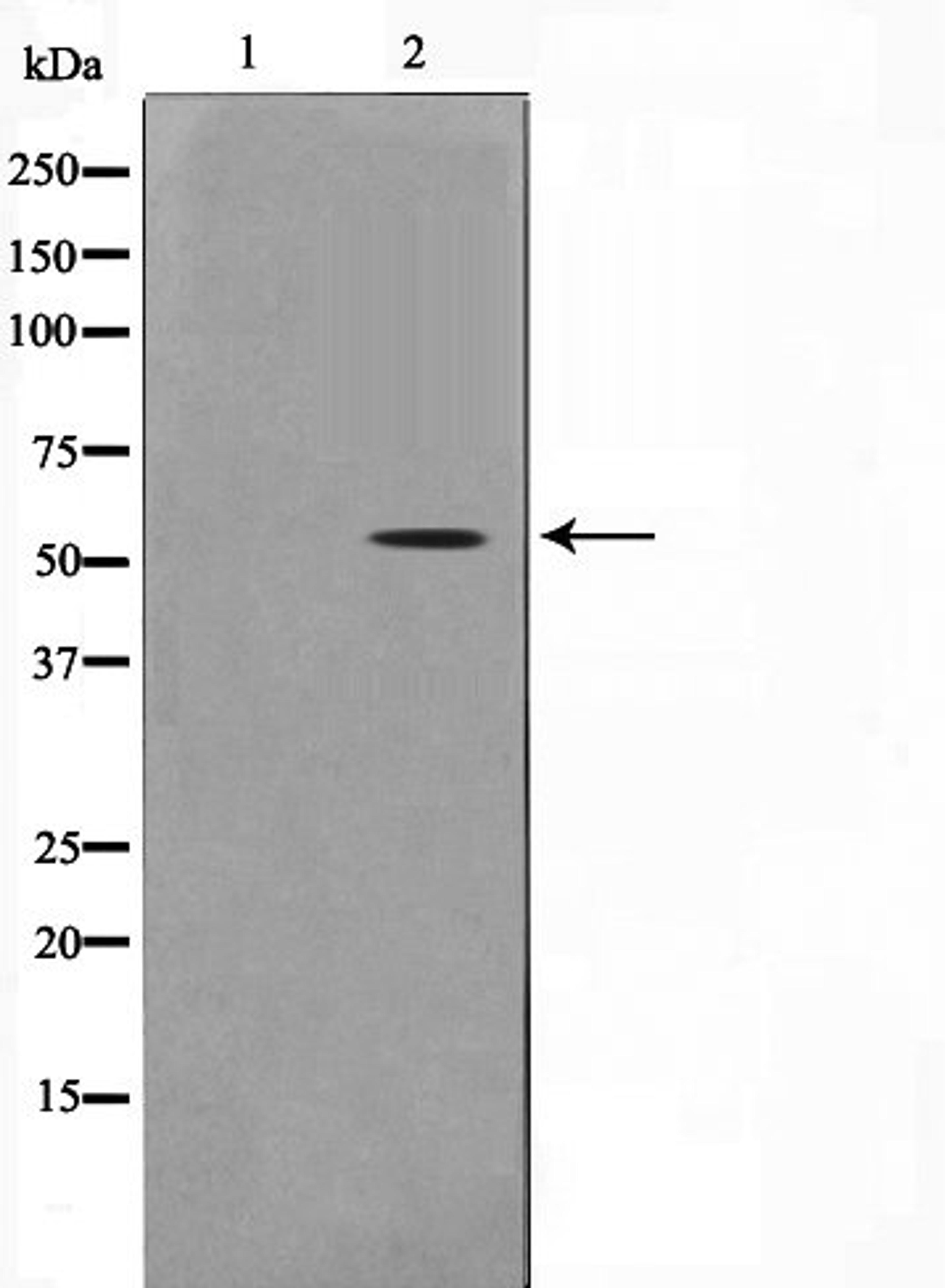 Western blot analysis of COLO205 cell lysate using STEA3 antibody