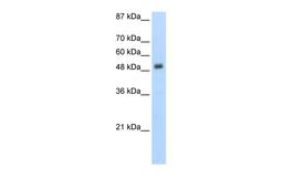 Antibody used in WB on Human Jurkat 5.0 ug/ml.