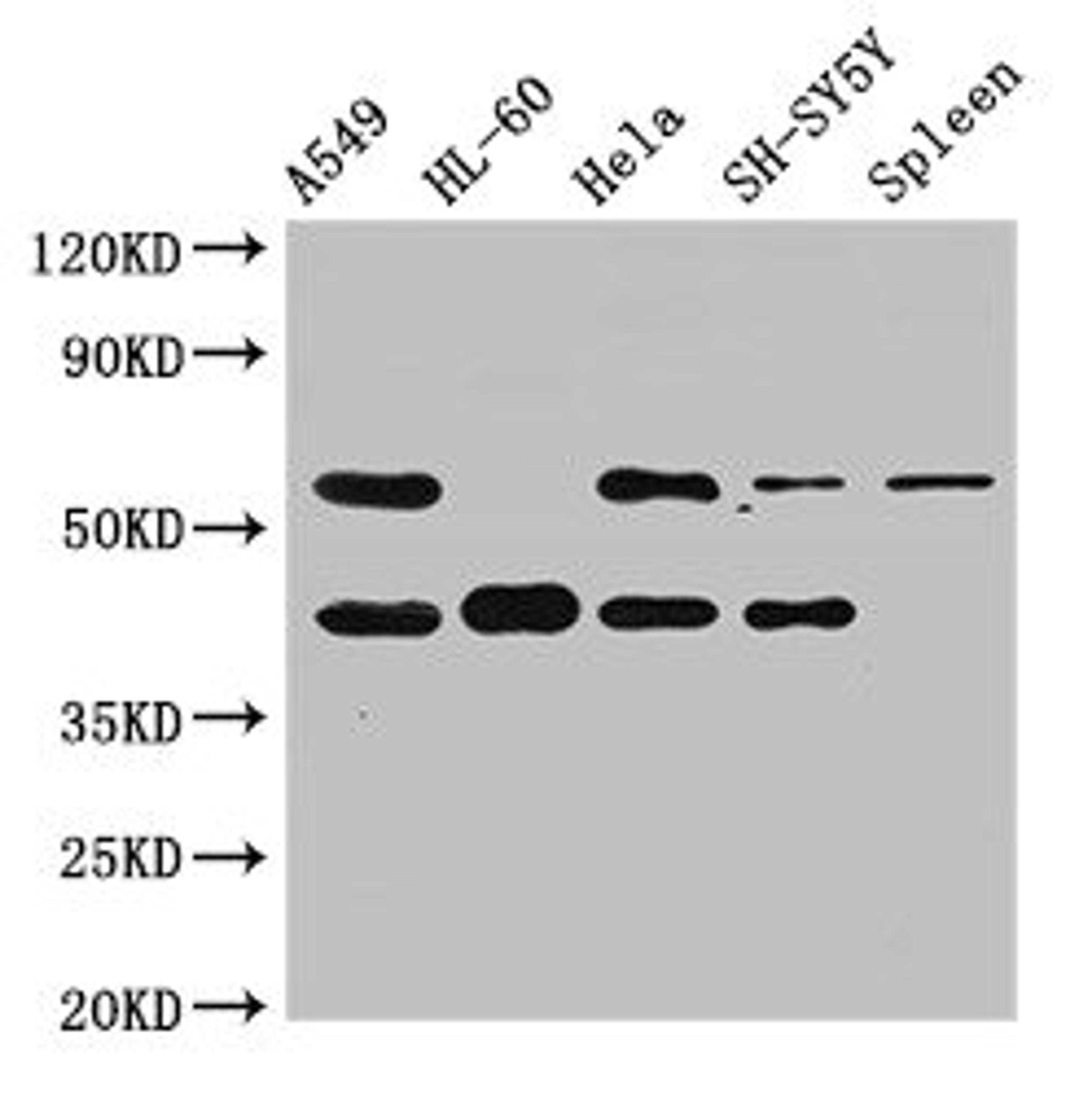Western Blot. Positive WB detected in: A549 whole cell lysate, HL60 whole cell lysate, Hela whole cell lysate, SH-SY5Y whole cell lysate, Rat spleen tissue. All lanes: BACE2 antibody at 2.5ug/ml. Secondary. Goat polyclonal to rabbit IgG at 1/50000 dilution. Predicted band size: 57, 51, 43, 39, 47 kDa. Observed band size: 57, 43 kDa. 