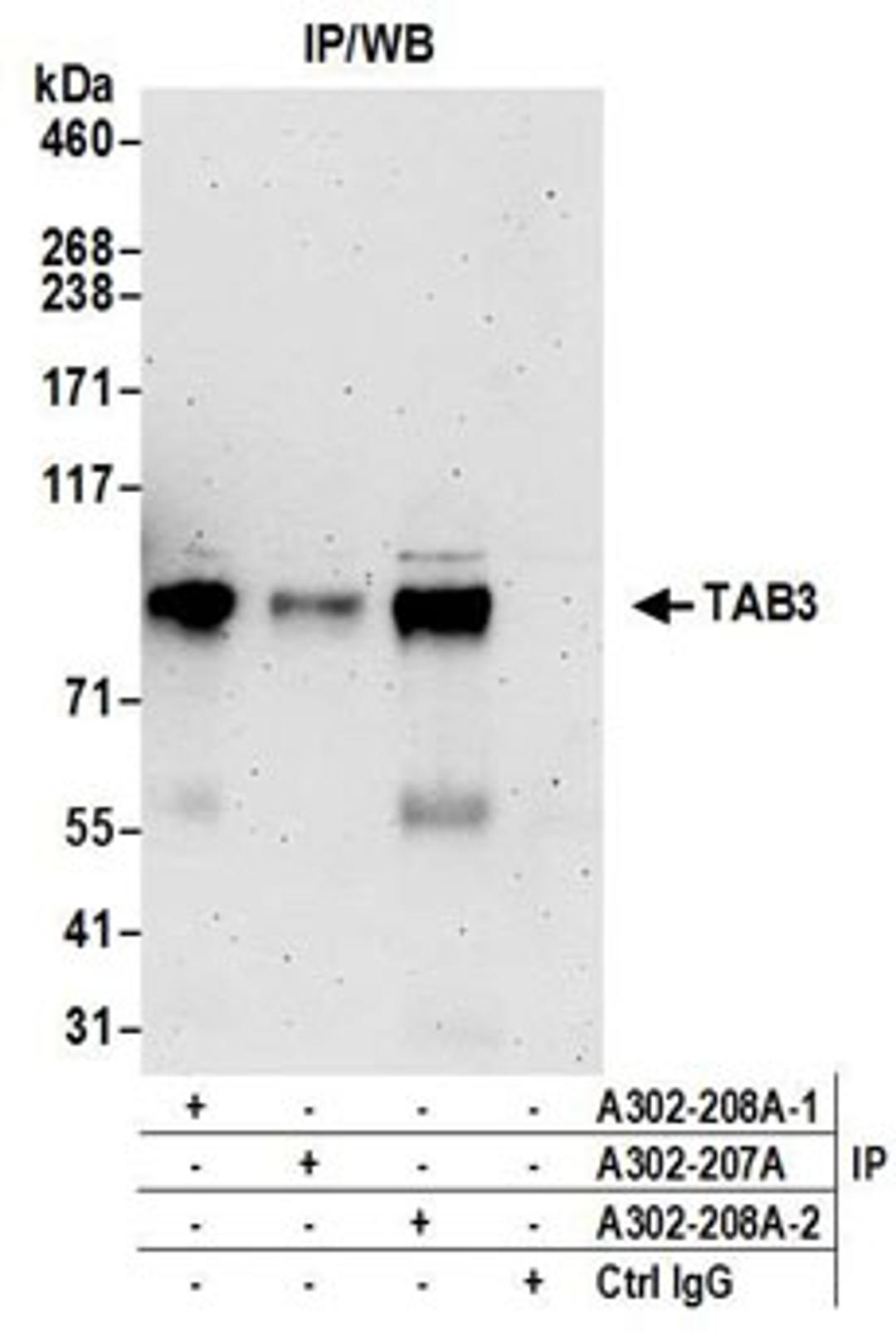 Detection of human TAB3 by western blot of immunoprecipitates.