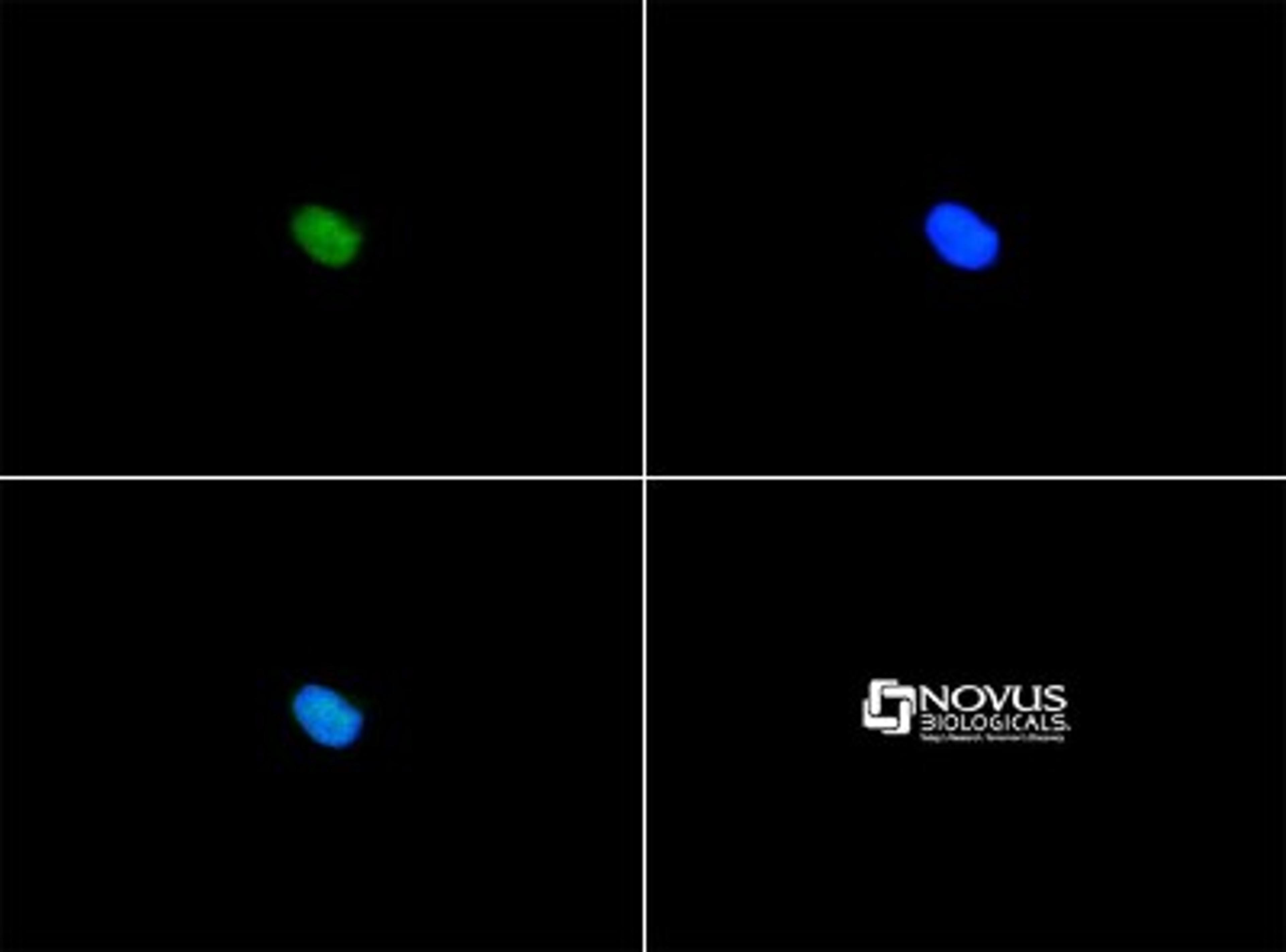 Immunocytochemistry/Immunofluorescence: SERF1A Antibody [NBP1-78392] - Serf1a antibody was tested in Ntera2 cells with FITC (green). Nuclei were counterstained with DAPI (blue).