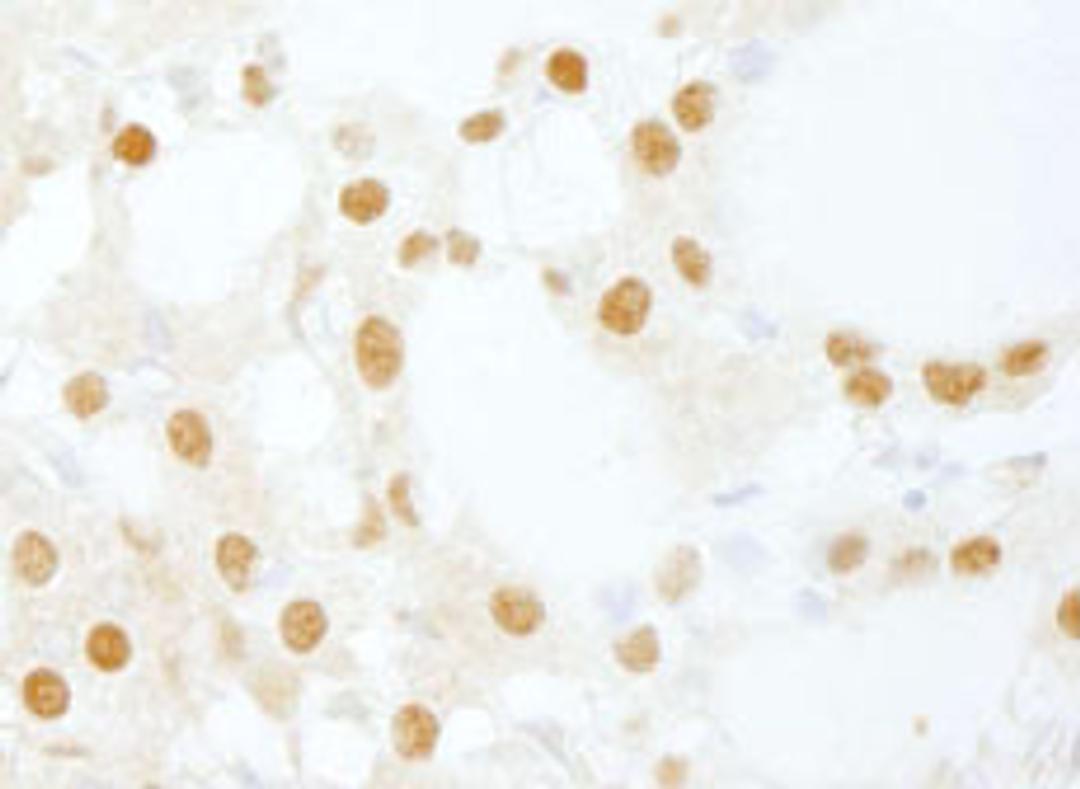 Detection of human DDX26/DICE1 by immunohistochemistry.