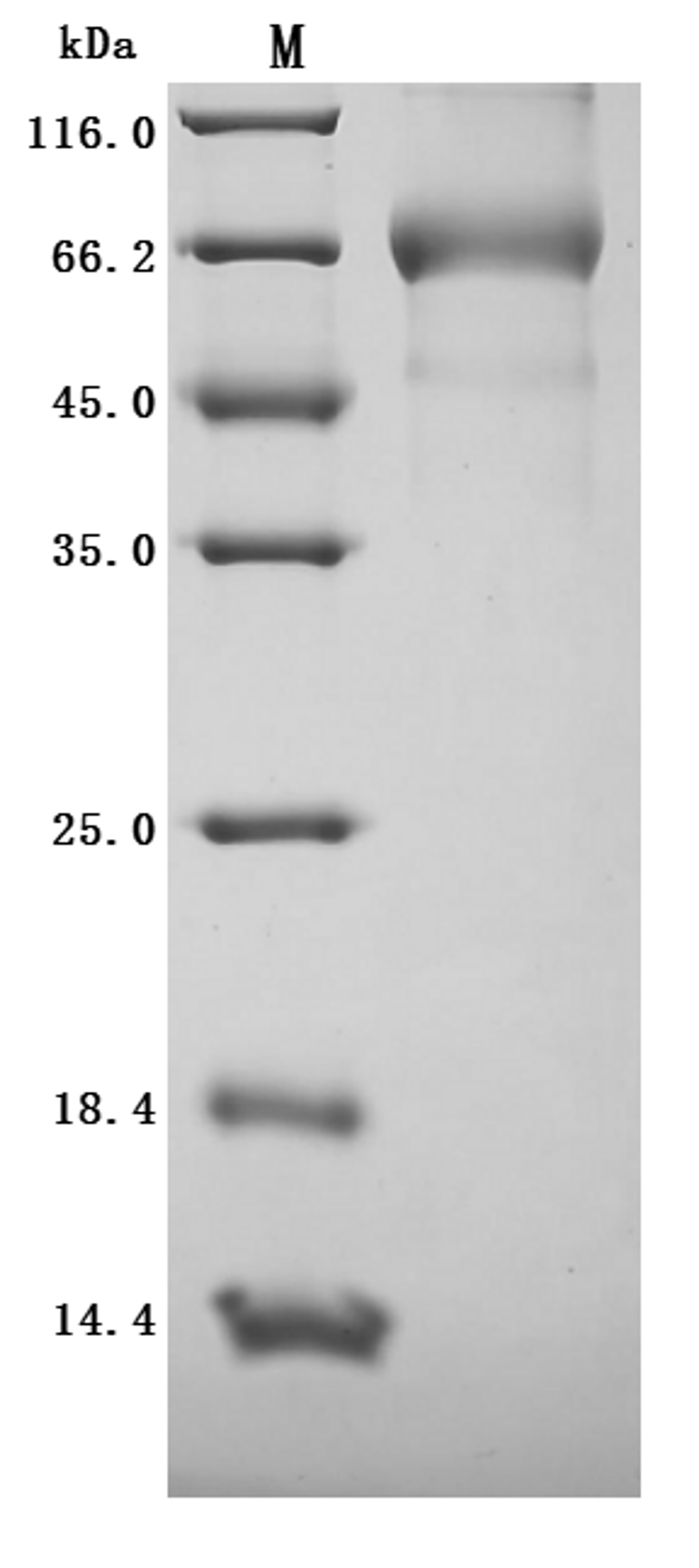 (Tris-Glycine gel) Discontinuous SDS-PAGE (reduced) with 5% enrichment gel and 15% separation gel.