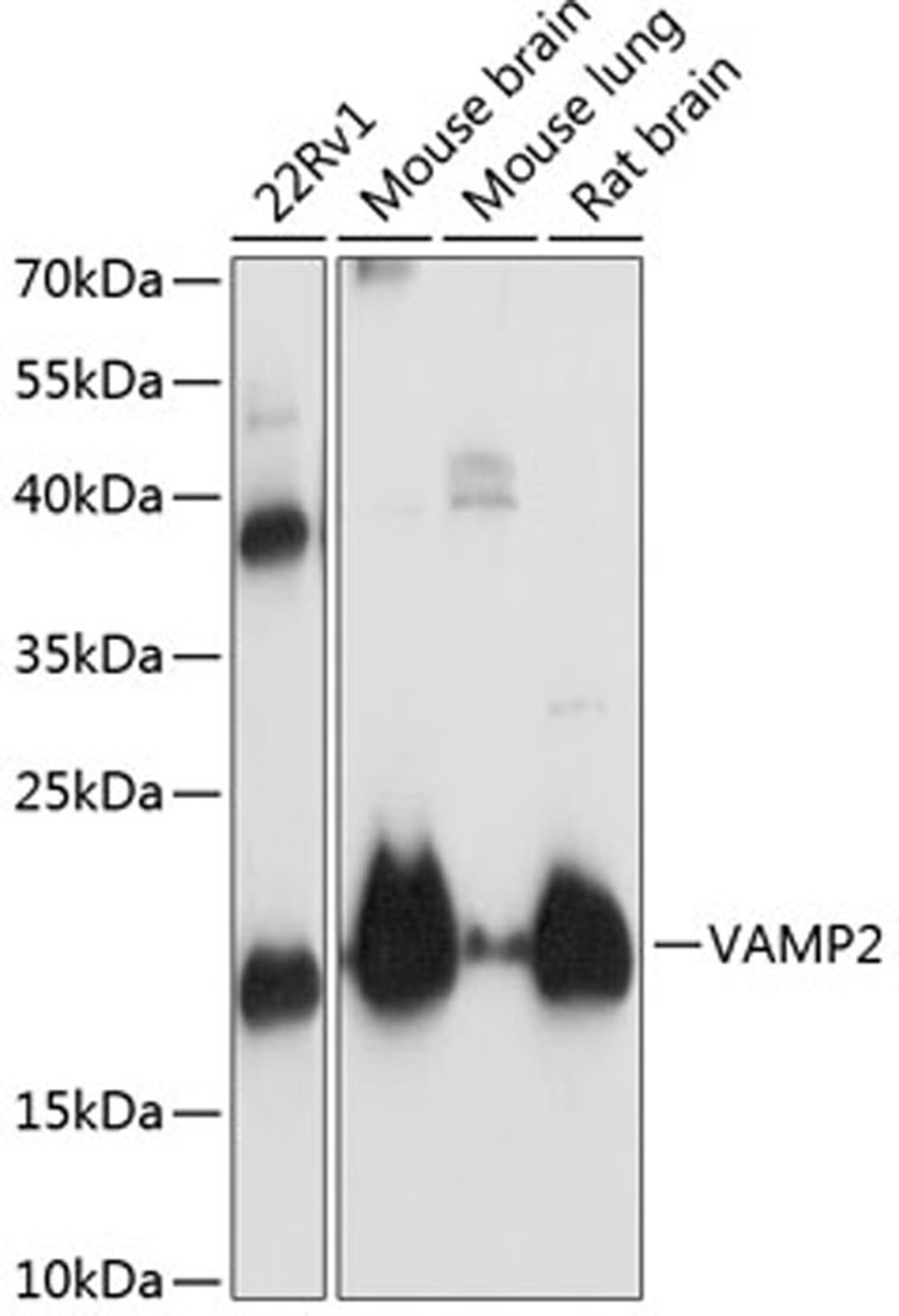 Western blot - VAMP2 antibody (A1249)