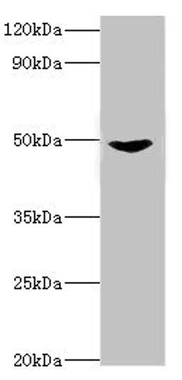 Western blot. All lanes: Dual specificity mitogen-activated protein kinase kinase 5 antibody at 2ug/ml + Rat heart tissue. Secondary. Goat polyclonal to rabbit IgG at 1/10000 dilution. Predicted band size: 51, 49, 50, 47 kDa. Observed band size: 51 kDa. 