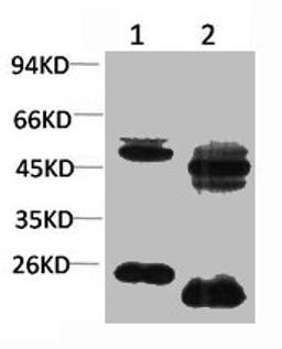 Western blot analysis of 1) Rat Brain Tissue, 2)Mouse Brain Tissue with KV1.8 Rabbit pAb diluted at 1:2,000.