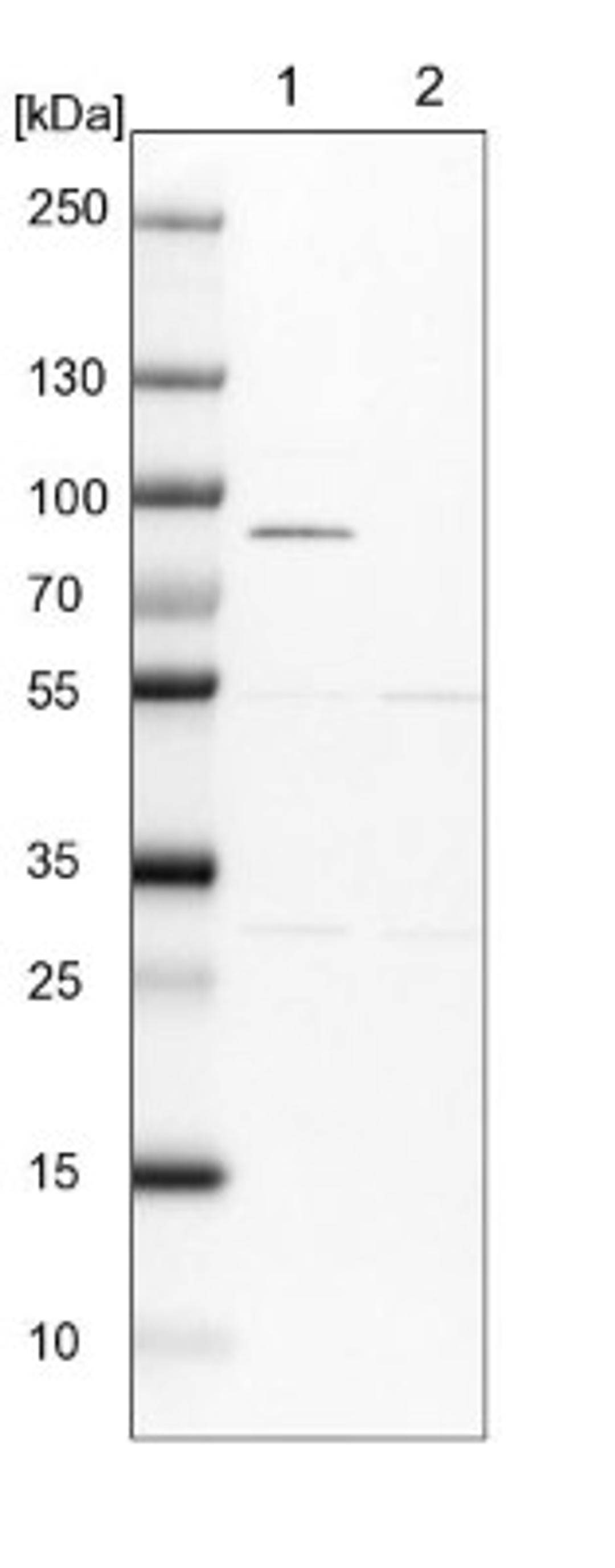 Western Blot: NEK8 Antibody [NBP1-82539] - Lane 1: NIH-3T3 cell lysate (Mouse embryonic fibroblast cells)<br/>Lane 2: NBT-II cell lysate (Rat Wistar bladder tumour cells)