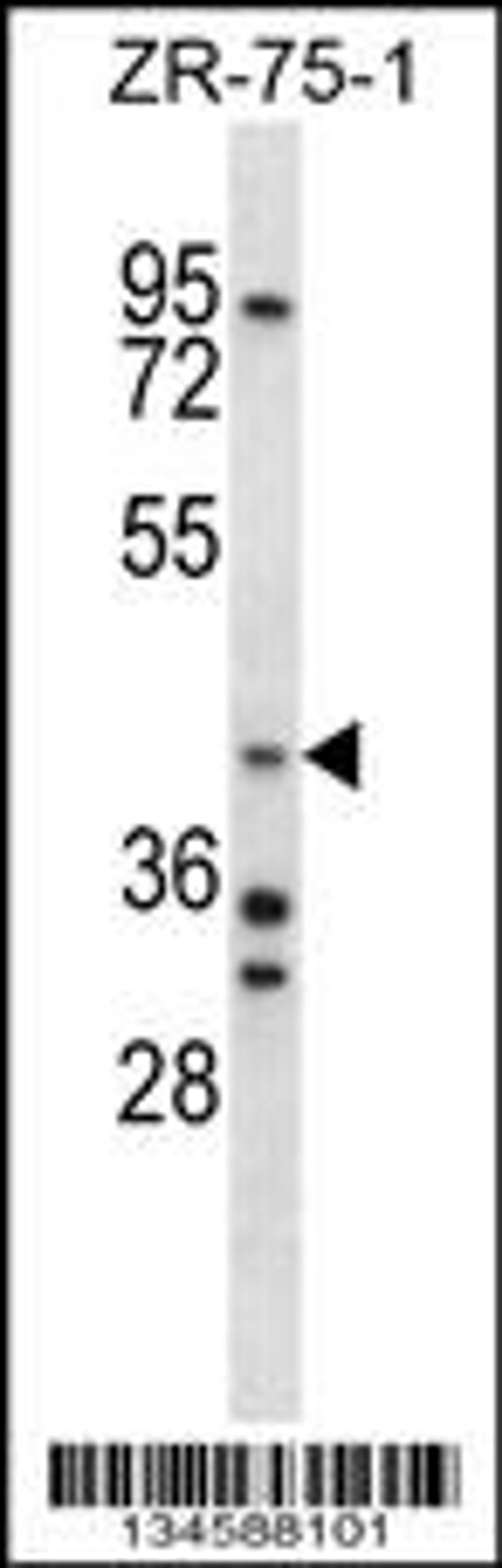 Western blot analysis in ZR-75-1 cell line lysates (35ug/lane).