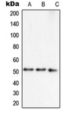 Western blot analysis of MCF7 (Lane 1), HepG2 (Lane 2), NIH3T3 (Lane 3) whole cell lysates using 41889 antibody