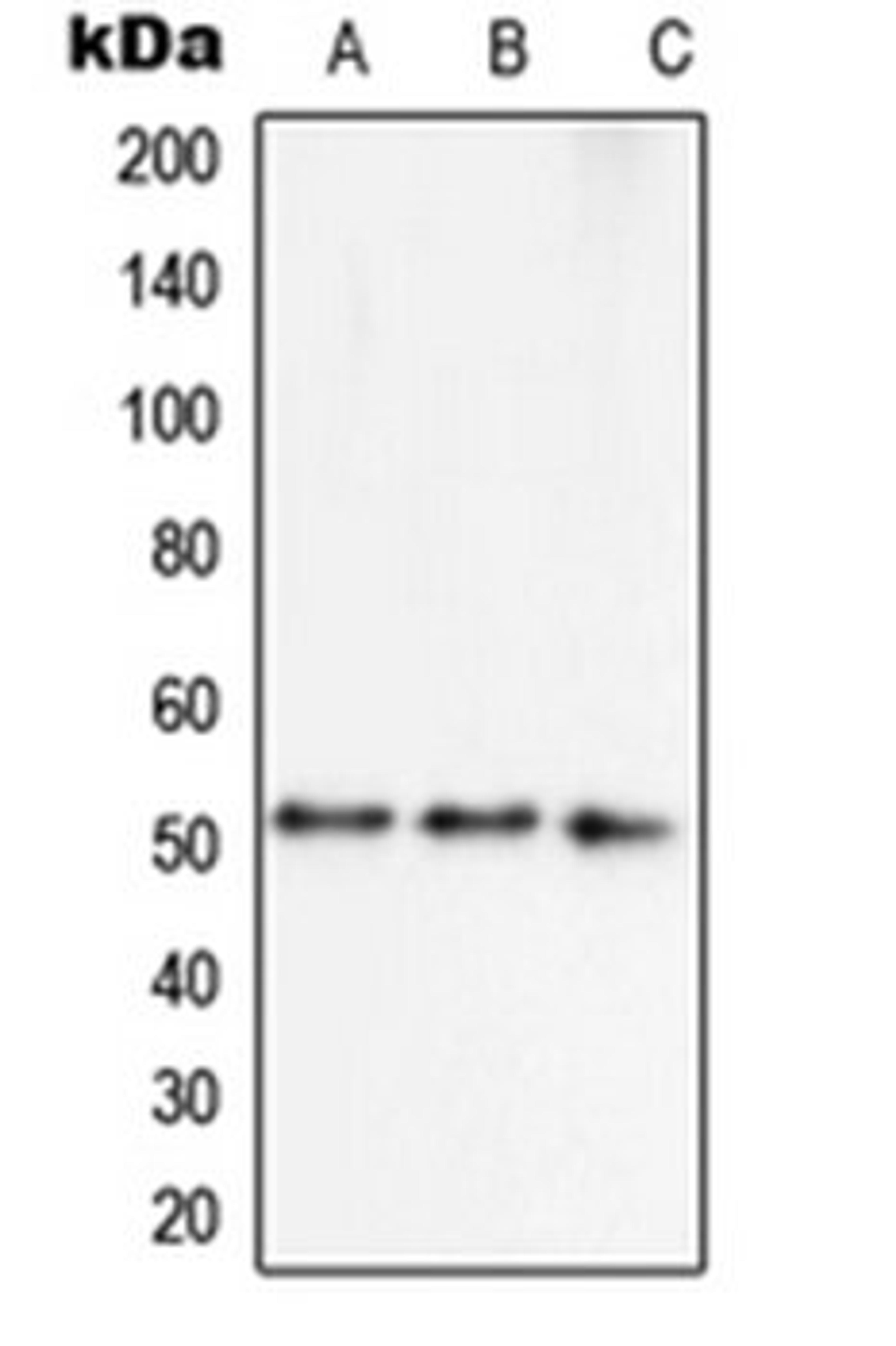 Western blot analysis of MCF7 (Lane 1), HepG2 (Lane 2), NIH3T3 (Lane 3) whole cell lysates using 41889 antibody