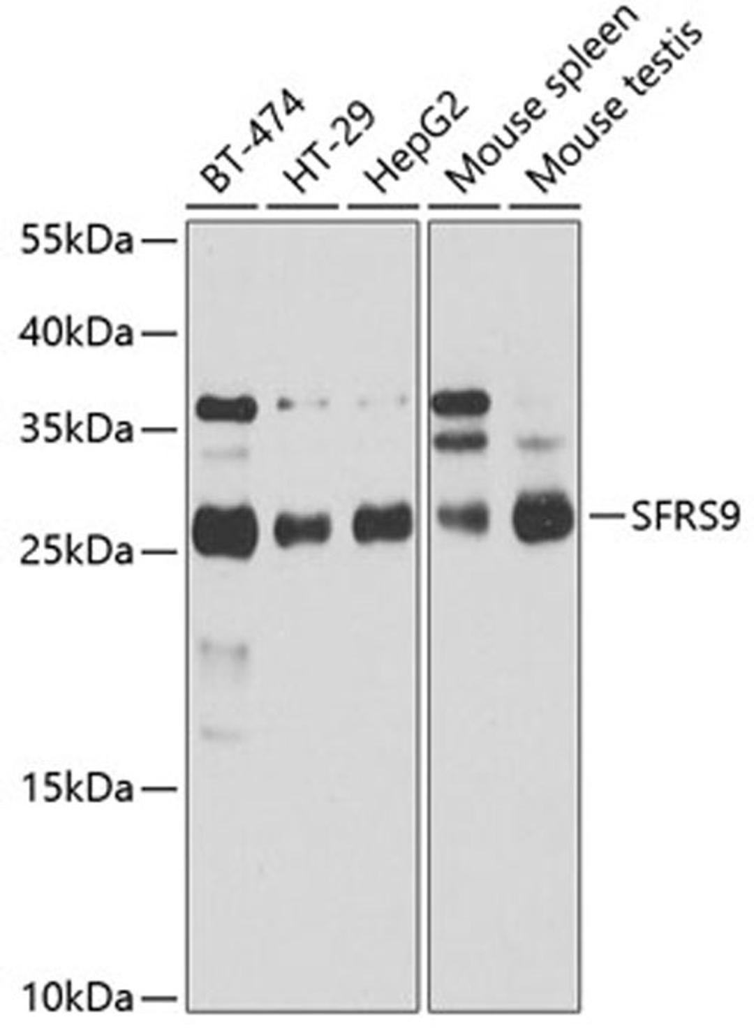 Western blot - SRSF9 antibody (A4242)