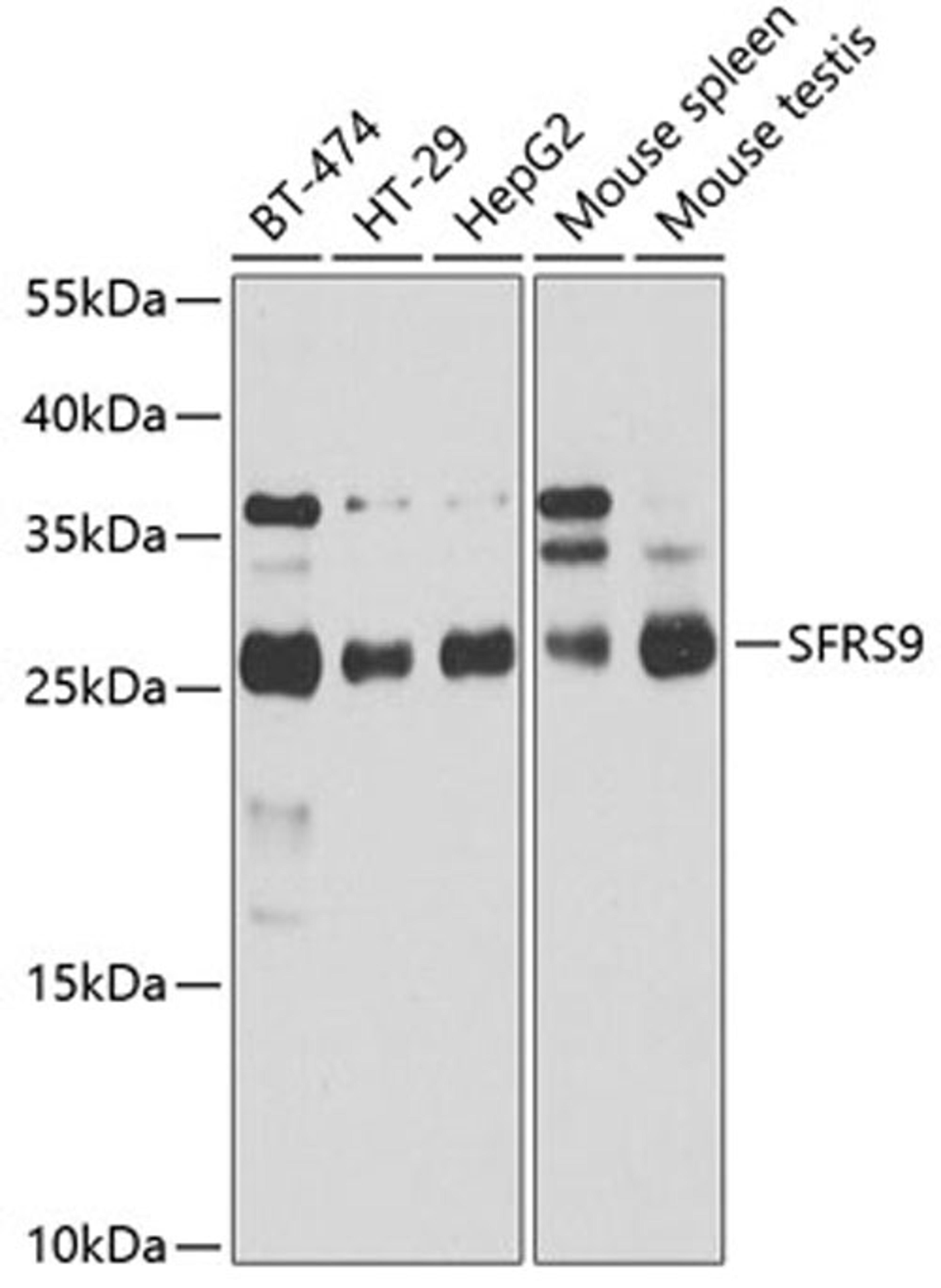 Western blot - SRSF9 antibody (A4242)