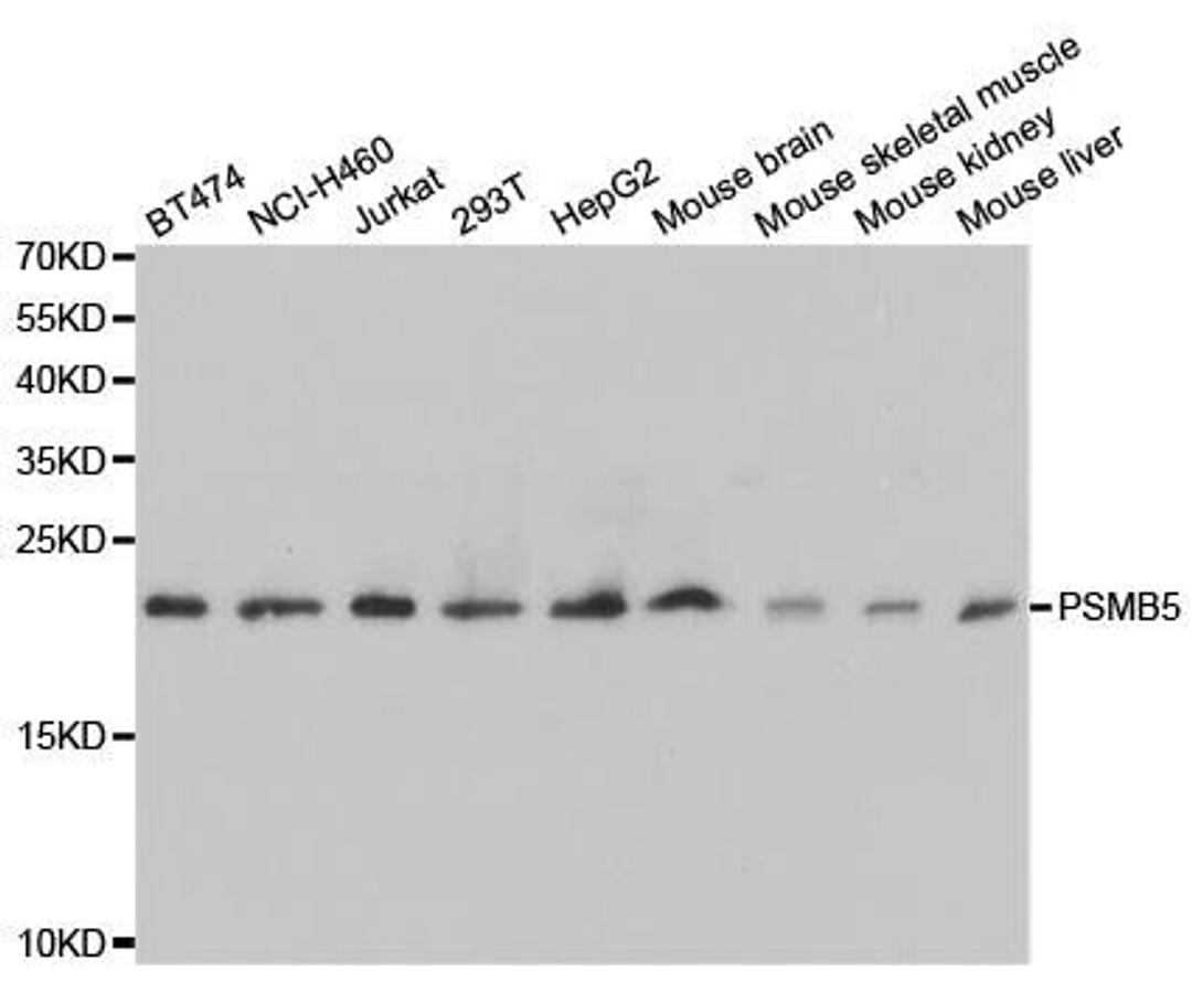 Western blot analysis of extracts of various cell lines using PSMB5 antibody