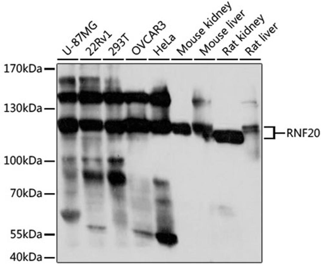 Western blot - RNF20 antibody (A17309)