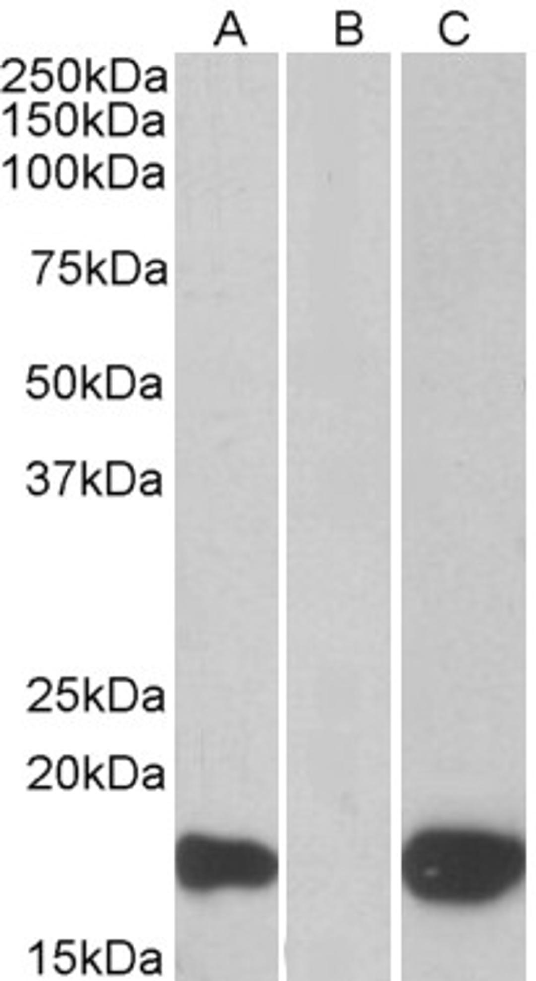 HEK293 lysate (10ug protein in RIPA buffer) overexpressing Human PHLDA3 with C-terminal MYC tag probed with 46-179 (1ug/ml) in Lane A and probed with anti-MYC Tag (1/1000) in lane C. Mock-transfected HEK293 probed with 46-179 (1mg/ml) in Lane B. Primary