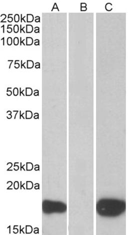 HEK293 lysate (10ug protein in RIPA buffer) overexpressing Human PHLDA3 with C-terminal MYC tag probed with 46-179 (1ug/ml) in Lane A and probed with anti-MYC Tag (1/1000) in lane C. Mock-transfected HEK293 probed with 46-179 (1mg/ml) in Lane B. Primary