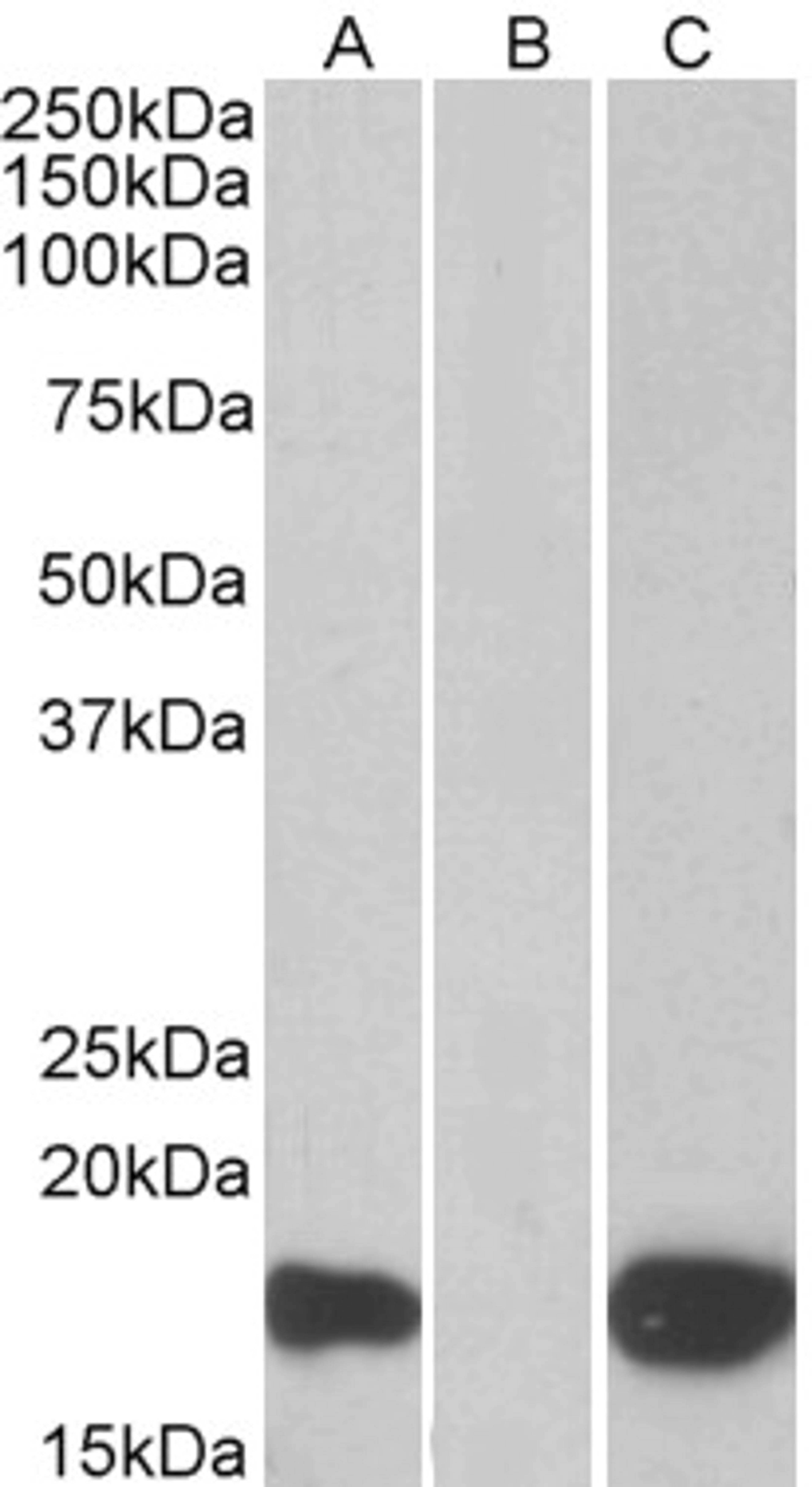 HEK293 lysate (10ug protein in RIPA buffer) overexpressing Human PHLDA3 with C-terminal MYC tag probed with 46-179 (1ug/ml) in Lane A and probed with anti-MYC Tag (1/1000) in lane C. Mock-transfected HEK293 probed with 46-179 (1mg/ml) in Lane B. Primary