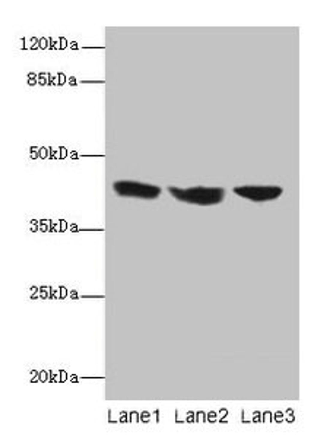 Western blot. All lanes: IL2RG antibody at 12µg/ml. Lane 1: Jurkat whole cell lysate. Lane 2: K562 whole cell lysate. Lane 3: HL60 whole cell lysate. Secondary. Goat polyclonal to rabbit IgG at 1/10000 dilution. Predicted band size: 43, 21 kDa. Observed band size: 43 kDa