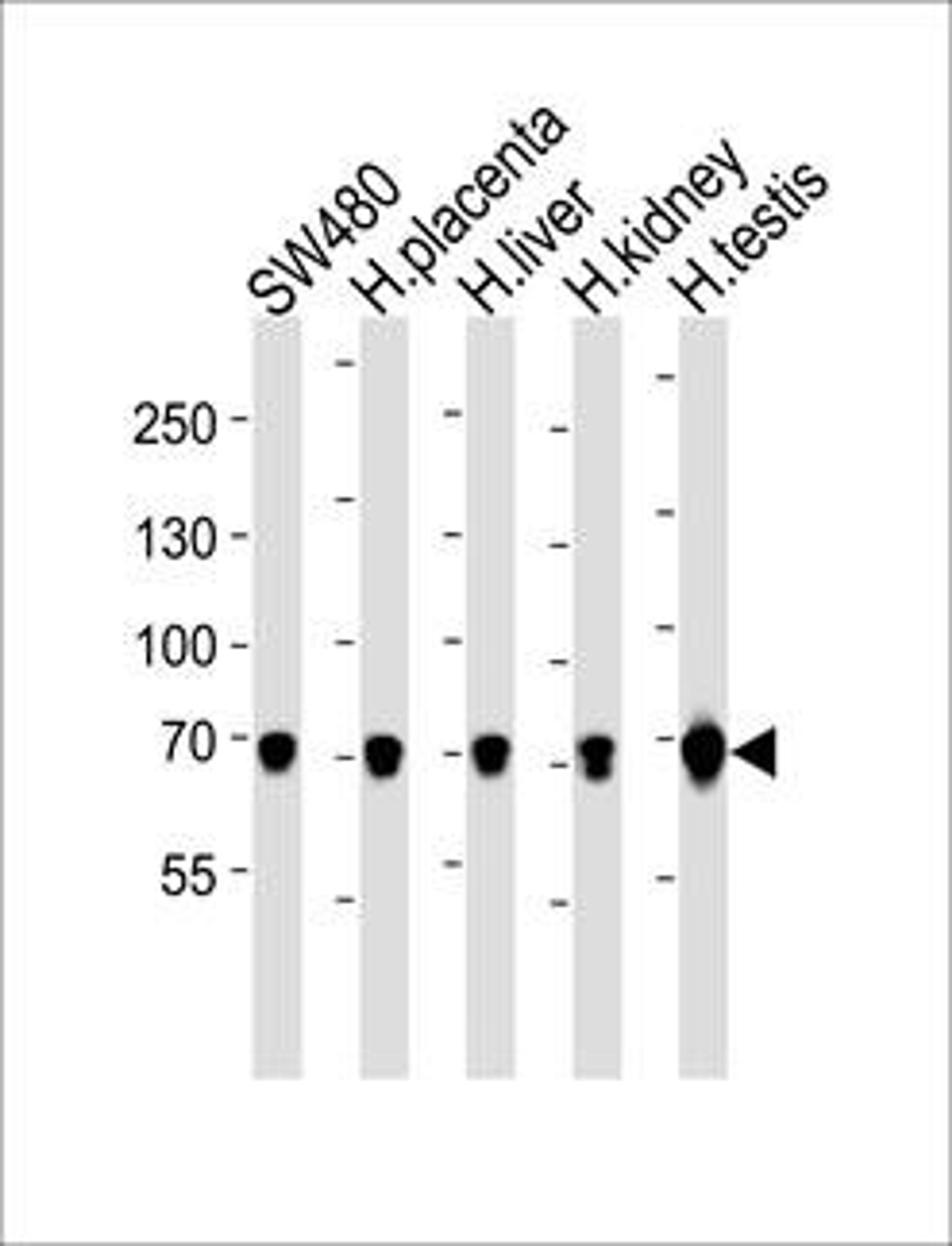 Western blot analysis of SW480 cell line human placenta, huamn liver, kidney and testis tissue lysate (from left to right)using TRPV6 antibody (primary antibody dilution at: 1:1000)