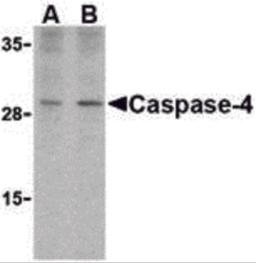 Western blot analysis of caspase-4 in human spleen cells with caspase-4 antibody at (A) 1 and (B) 2 &#956;g/mL.