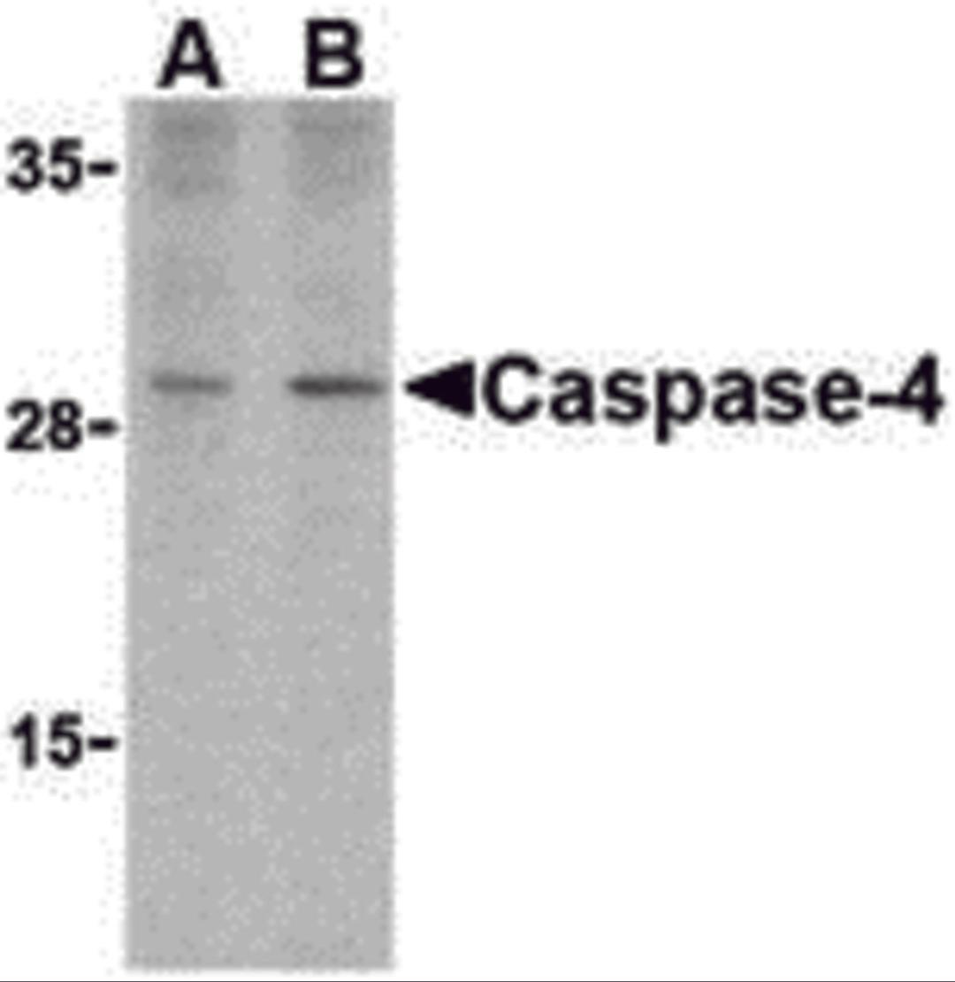 Western blot analysis of caspase-4 in human spleen cells with caspase-4 antibody at (A) 1 and (B) 2 μg/mL.
