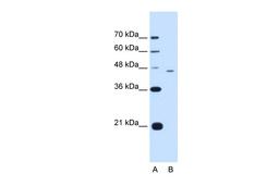 Antibody used in WB on Human HepG2 cells at 1.25 ug/ml.