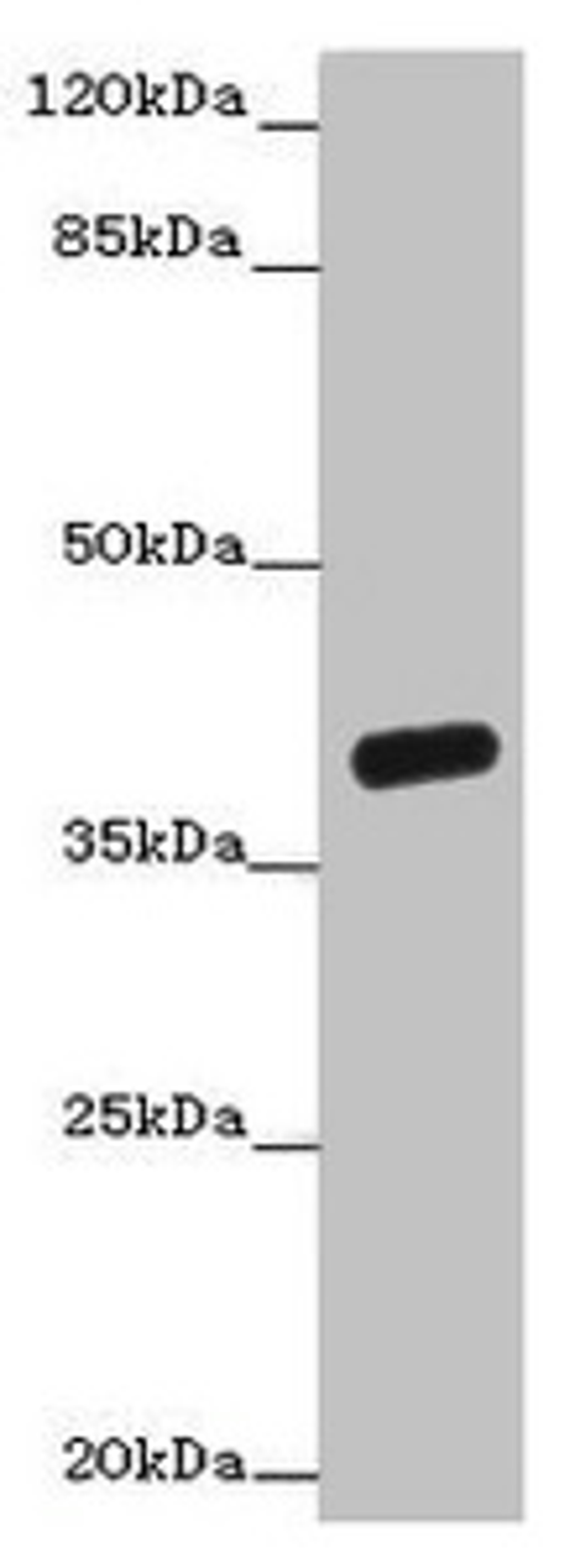 Western blot. All lanes: OGFOD2 antibody at 3µg/ml + Mouse liver tissue. Secondary. Goat polyclonal to rabbit IgG at 1/10000 dilution. Predicted band size: 39, 33, 15, 21 kDa. Observed band size: 39 kDa