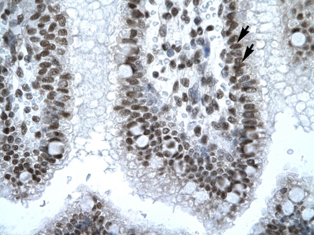 Antibody used in IHC on Human Intestine.