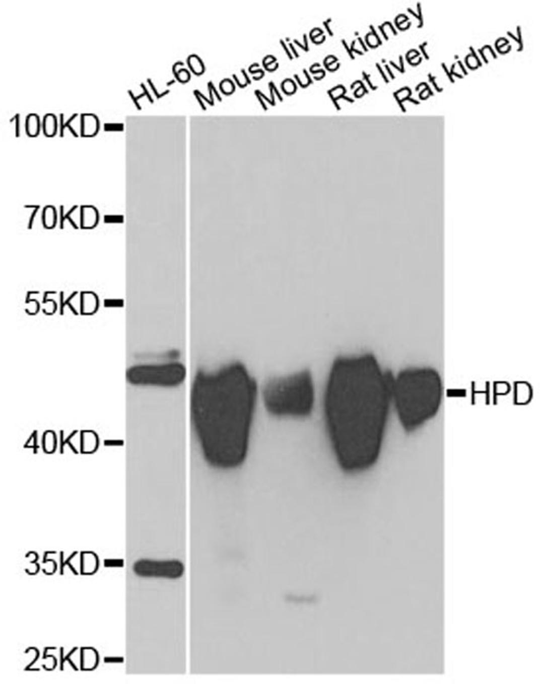 Western blot - HPD antibody (A6505)