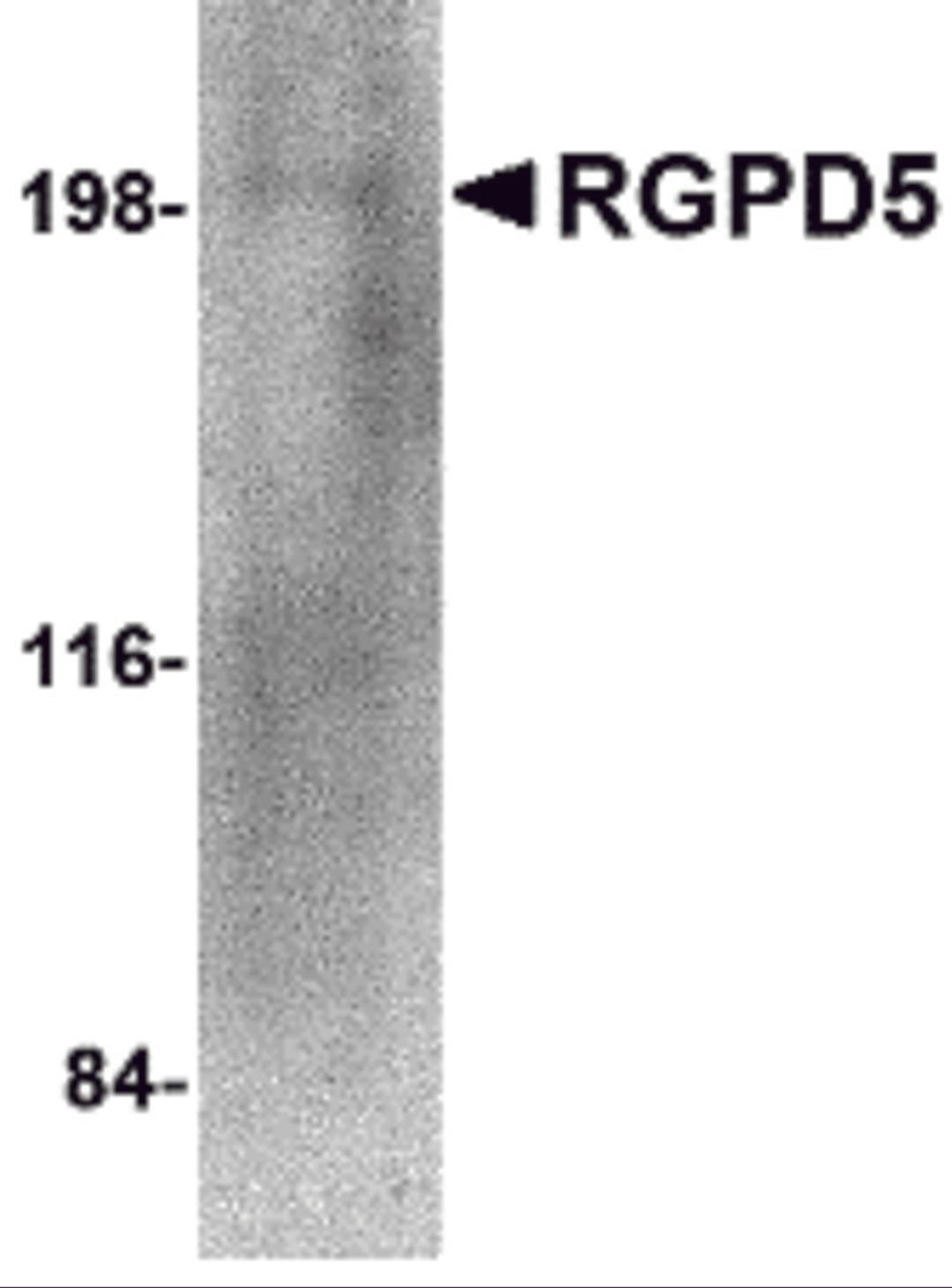 Western blot analysis of RGPD5 in human thymus tissue lysate with RGPD5 antibody at 1 μg/mL.