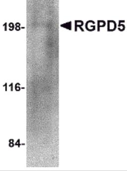 Western blot analysis of RGPD5 in human thymus tissue lysate with RGPD5 antibody at 1 μg/mL.