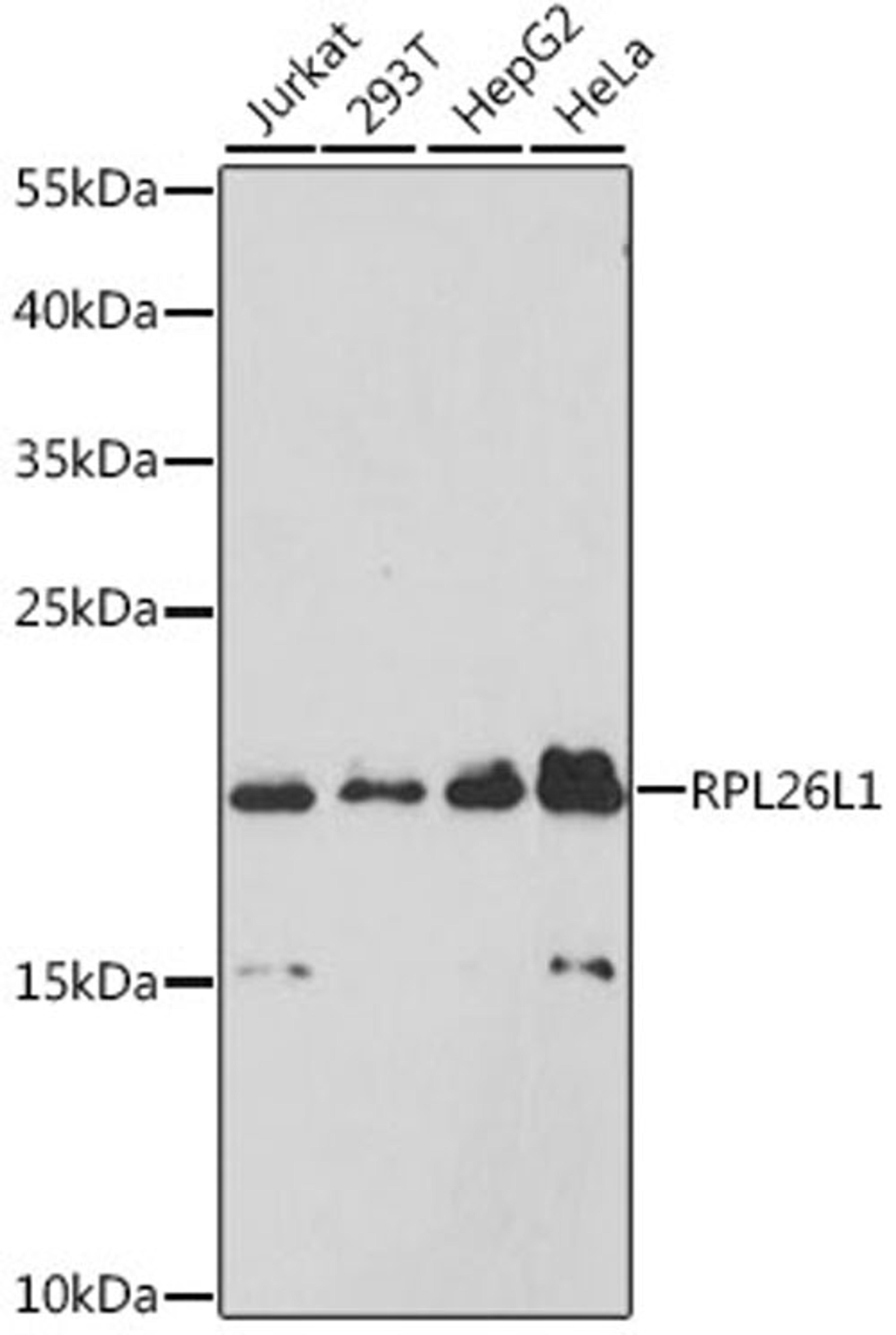 Western blot - RPL26L1 antibody (A9192)