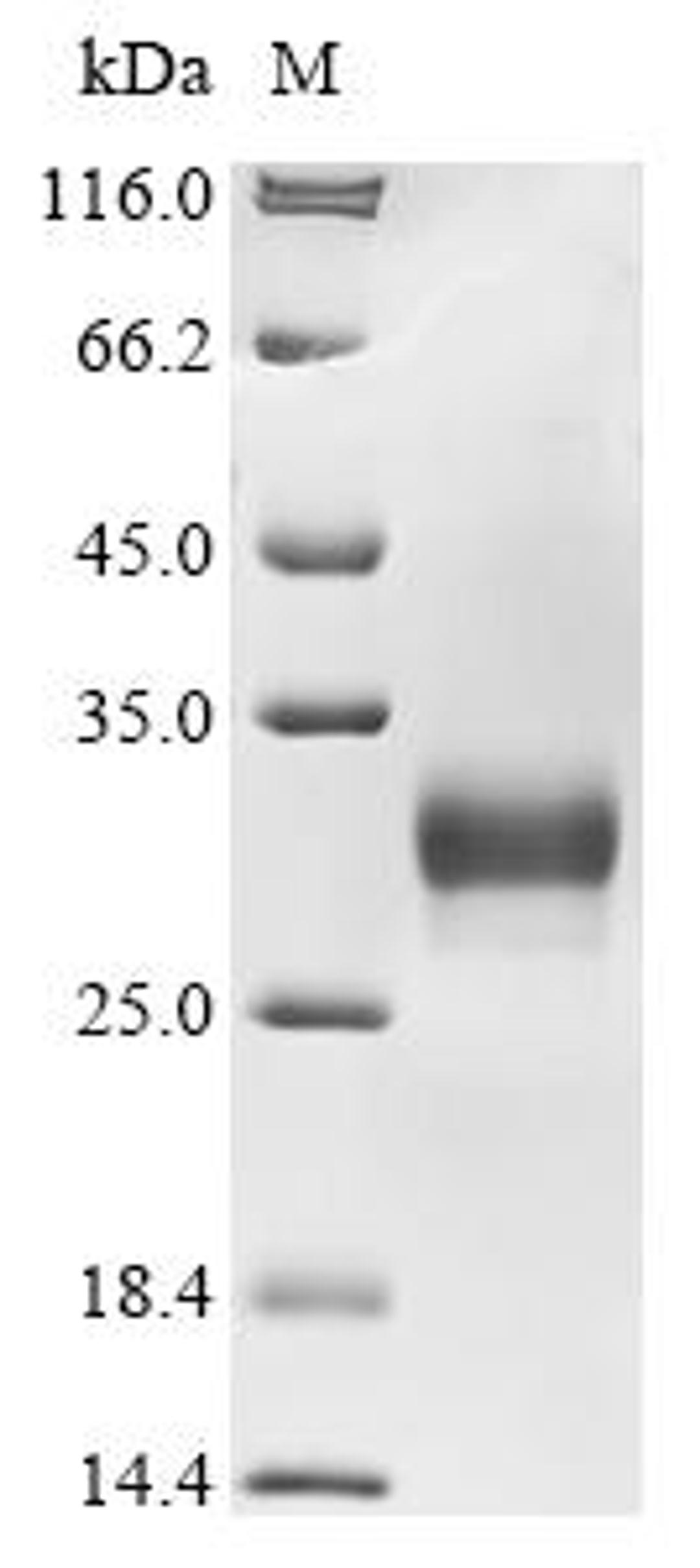 (Tris-Glycine gel) Discontinuous SDS-PAGE (reduced) with 5% enrichment gel and 15% separation gel.