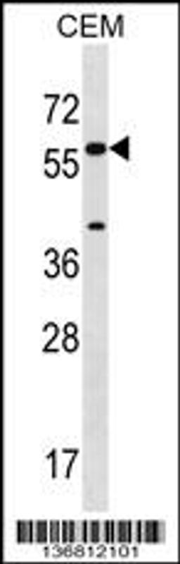 Western blot analysis in CEM cell line lysates (35ug/lane).