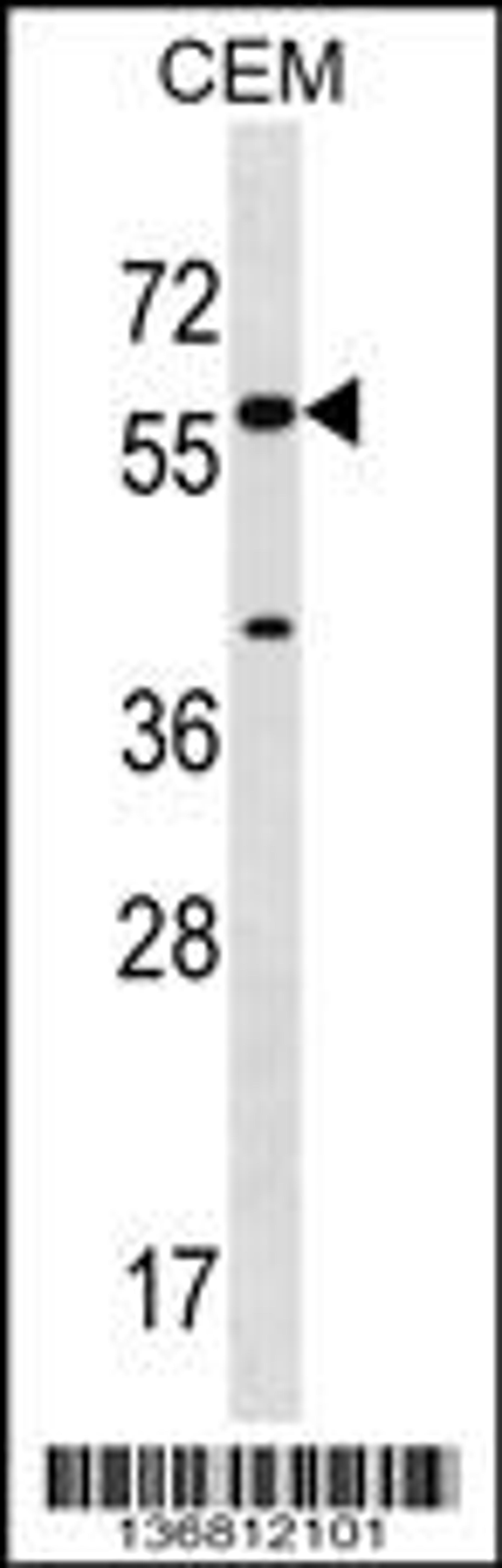 Western blot analysis in CEM cell line lysates (35ug/lane).