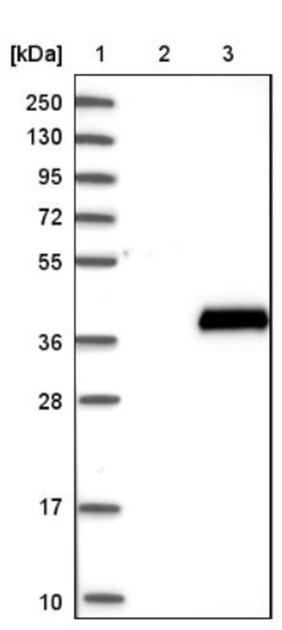 Western Blot: SULT4A1 Antibody [NBP1-81770] - Lane 1: Marker [kDa] 250, 130, 95, 72, 55, 36, 28, 17, 10<br/>Lane 2: Negative control (vector only transfected HEK293T lysate)<br/>Lane 3: Over-expression lysate (Co-expressed with a C-terminal myc-DDK tag (~3.1 kDa) in mammalian HEK293T cells, LY402319)