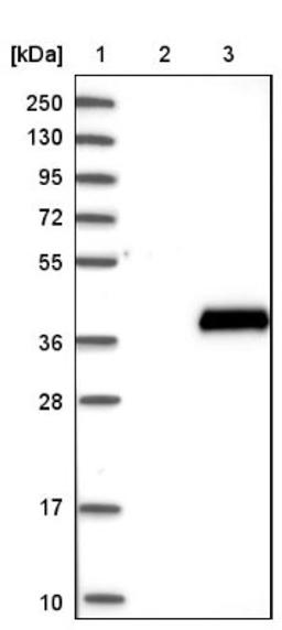 Western Blot: SULT4A1 Antibody [NBP1-81770] - Lane 1: Marker [kDa] 250, 130, 95, 72, 55, 36, 28, 17, 10<br/>Lane 2: Negative control (vector only transfected HEK293T lysate)<br/>Lane 3: Over-expression lysate (Co-expressed with a C-terminal myc-DDK tag (~3.1 kDa) in mammalian HEK293T cells, LY402319)