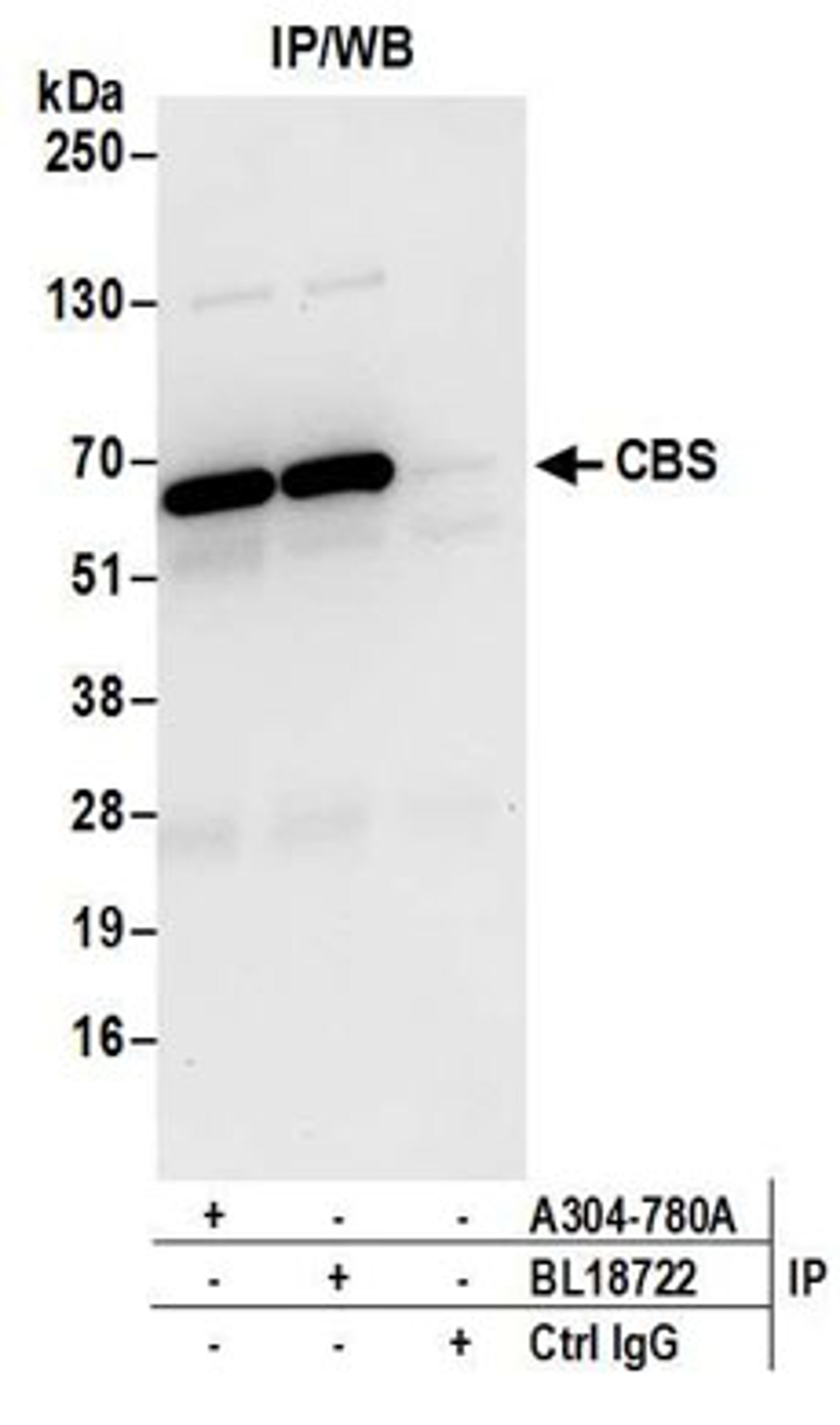 Detection of human CBS by western blot of immunoprecipitates.