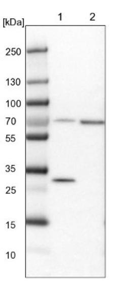 Western Blot: HSD17B13 Antibody [NBP1-90669] - Lane 1: Mouse liver tissue lysate<br/>Lane 2: Rat liver tissue lysate