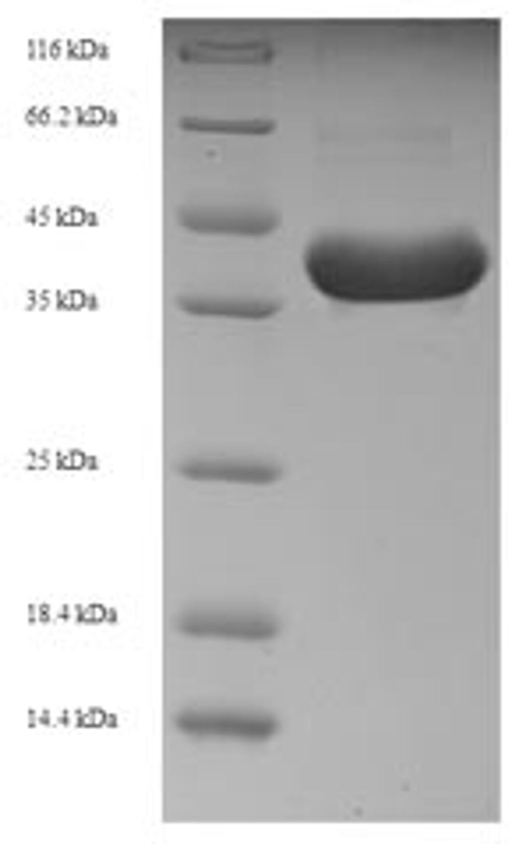 (Tris-Glycine gel) Discontinuous SDS-PAGE (reduced) with 5% enrichment gel and 15% separation gel.