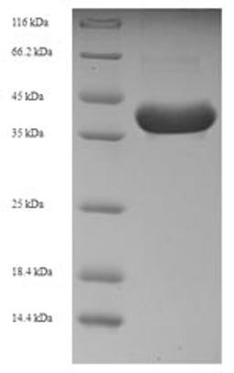 (Tris-Glycine gel) Discontinuous SDS-PAGE (reduced) with 5% enrichment gel and 15% separation gel.